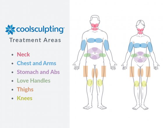 CoolSculpting.jpg